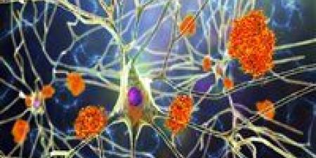 "النبات
      المعجزة"..
      مفتاح
      جديد
      لعلاج
      ألزهايمر - كورة نيوز