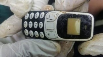 صدق أو لا تصدق.. استخراج هاتف محمول من معدة مريض بعد عامين