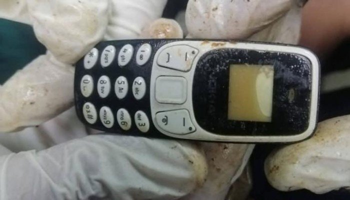 صدق أو لا تصدق.. استخراج هاتف محمول من معدة مريض بعد عامين